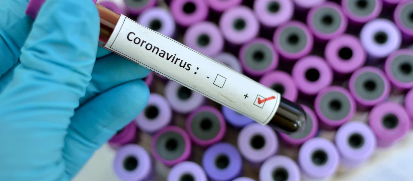 Κορωνοϊός: Πού μπορείτε να κάνετε το τεστ - Η διαδικασία και το κόστος